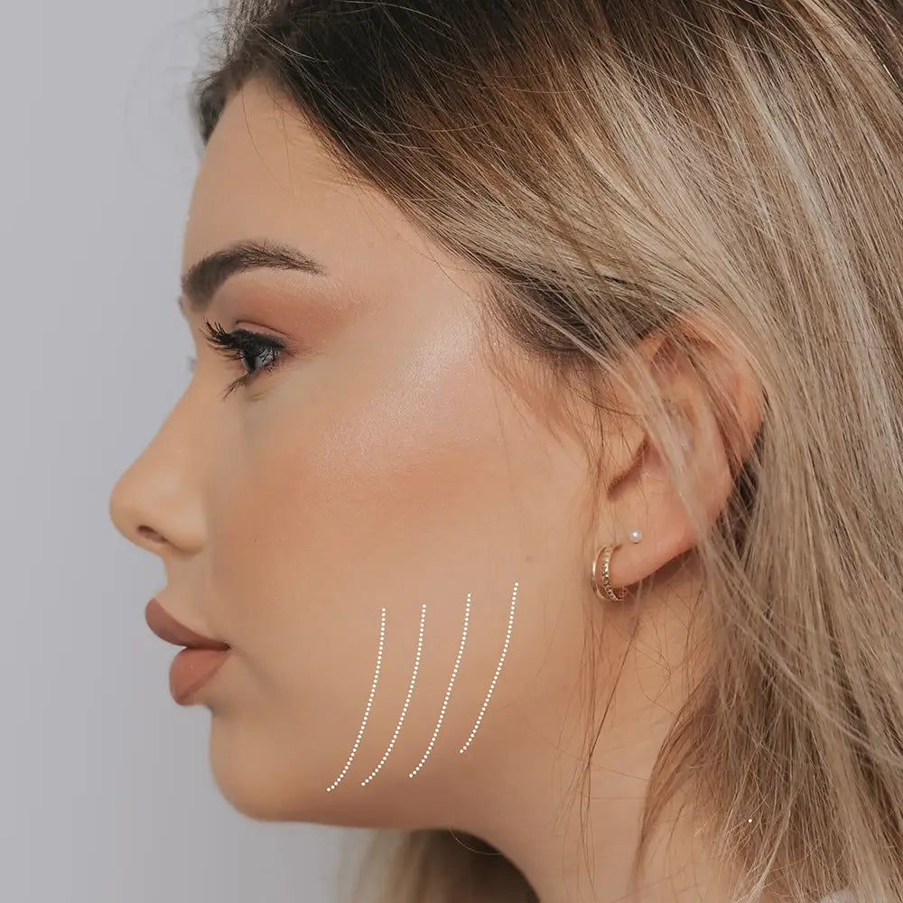 Masseter