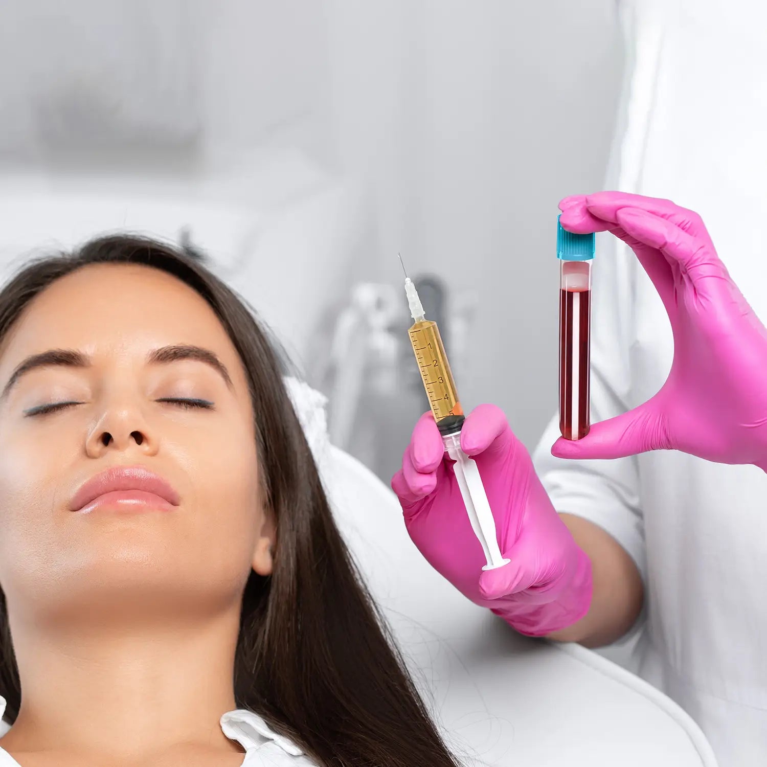 PRP therapy